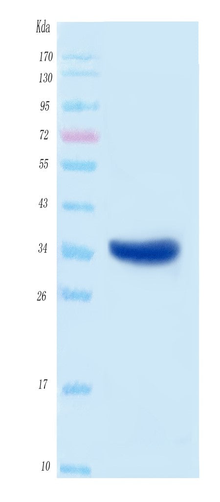 SARS-CoV-2 (COVID-19) NSP5A Protein, His Tag Boster Bio