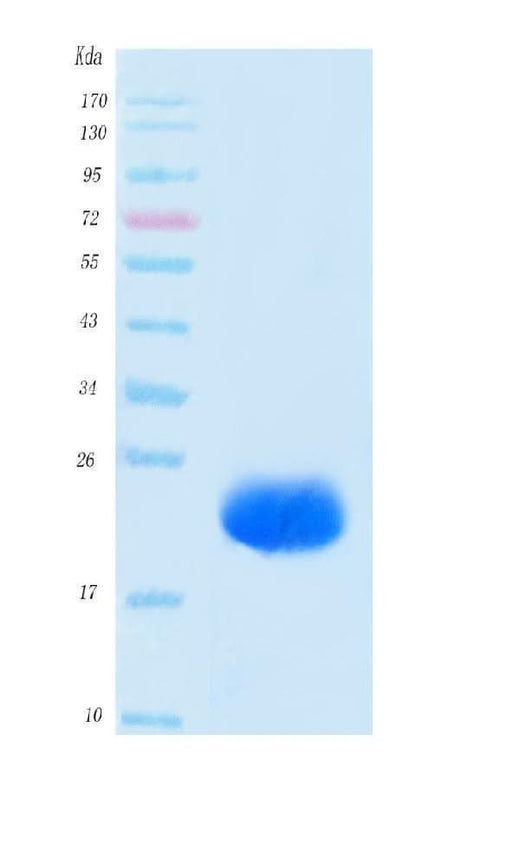 SARS-CoV-2 (COVID-19) NSP8 Protein, His Tag Boster Bio