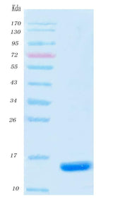 SARS-CoV-2 (COVID-19) NSP9 Protein, His Tag Boster Bio