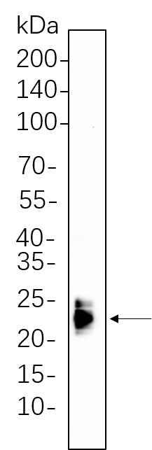 Anti-Mouse/Rat ASC Antibody [B1109] - ABMIUM