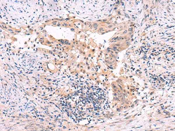 Anti-Human/Mouse/Rat SLC12A5 Antibody