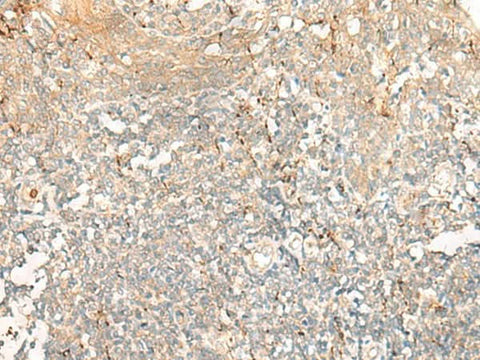 Immunohistochemistry of paraffin-embedded Human tonsil tissue using GCAT Polyclonal Antibody at dilution of 1:60(×200)