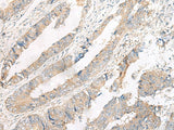 Anti-Human FERD3L Antibody - ABMIUM
