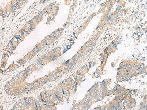 Anti-Human FERD3L Antibody - ABMIUM