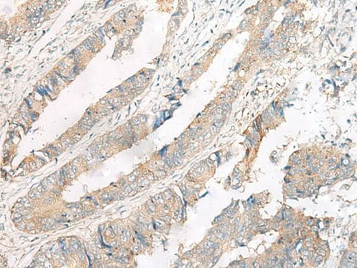 Anti-Human FERD3L Antibody - ABMIUM