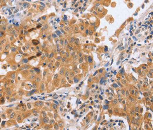 Anti-Human/Mouse/Rat BLNK Antibody