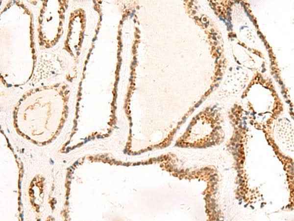 Anti-Human/Mouse DCAF10 Antibody