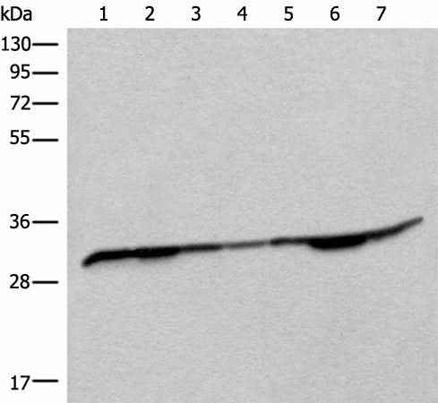 Anti-Human/Mouse/Rat RSU1 Antibody