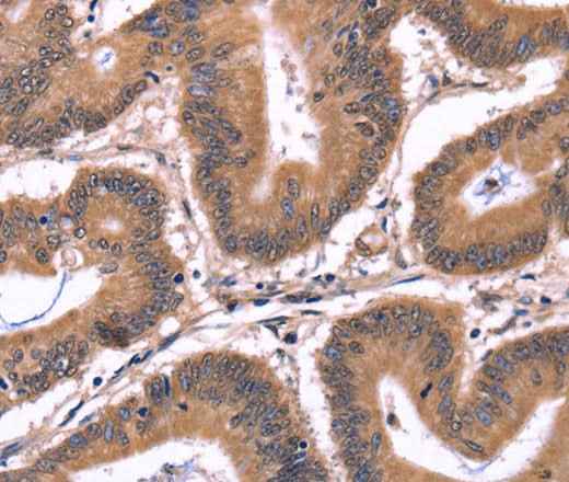 Anti-Human/Mouse/Rat CRK Antibody