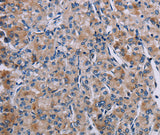 Anti-Human/Mouse/Rat KDM4D Antibody - ABMIUM
