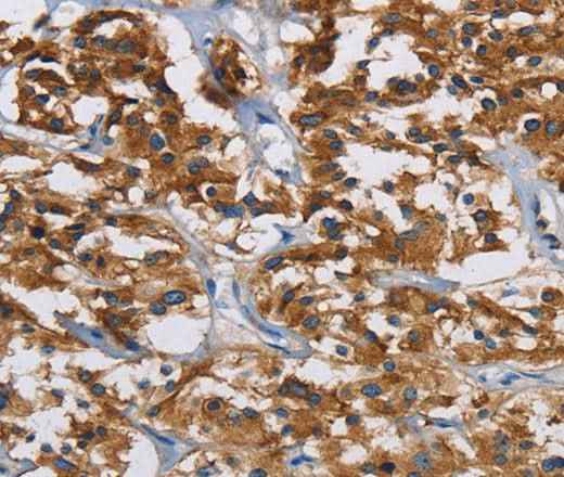 Anti-Human/Mouse IGF2R Antibody