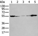 Western blot analysis of 293T A549 A431 Hela and Jurkat cell lysates using PFKFB3 Polyclonal Antibody at dilution of 1:400