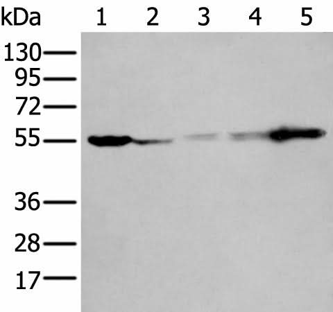 Western blot analysis of 293T A549 A431 Hela and Jurkat cell lysates using PFKFB3 Polyclonal Antibody at dilution of 1:400