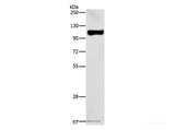 Anti-Human/Mouse STAT6 Antibody - ABMIUM