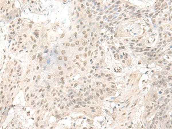 Anti-Human/Mouse/Rat ILKAP Antibody