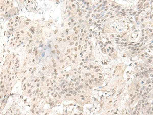 Anti-Human/Mouse/Rat ILKAP Antibody