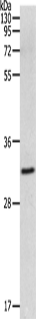 Anti-Human MMP26 Antibody - ABMIUM