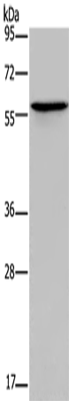 Anti-Human/Mouse/Rat ADRA1B Antibody - ABMIUM