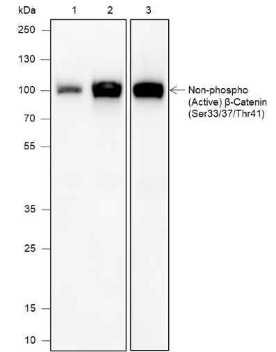 Anti-Human/Rat/Mouse Non-Phospho (Active) β-Catenin (Ser33, Ser37, Thr41) Antibody [A593] - ABMIUM