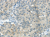 Anti-Human/Mouse GLP2R Antibody - ABMIUM