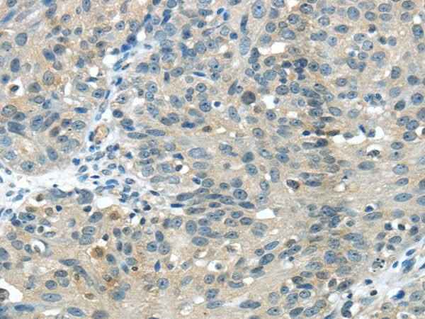 Anti-Human/Mouse GLP2R Antibody