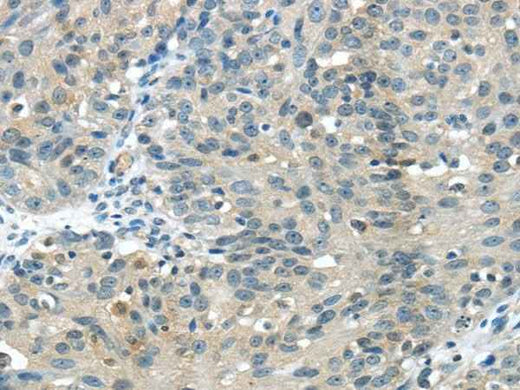 Anti-Human/Mouse GLP2R Antibody