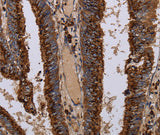Anti-Human/Rat PPP1R1B Antibody - ABMIUM