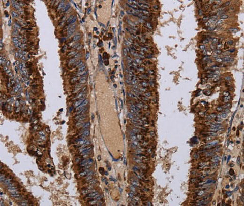 Anti-Human/Rat PPP1R1B Antibody - ABMIUM