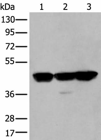 Western blot analysis of Hela A431 and Hepg2 cell lysates using PLAG1 Polyclonal Antibody at dilution of 1:200