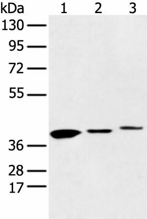 Western blot analysis of 231 cell Human fetal liver and Human fetal brain tissue using MAT2B Polyclonal Antibody at dilution of 1:500