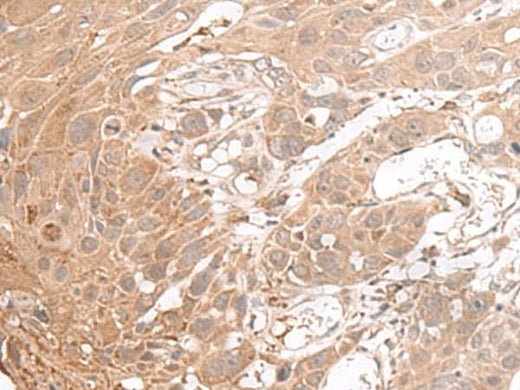 Anti-Human CHST4 Antibody - ABMIUM