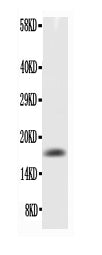 Anti-TNF alpha Antibody Picoband® Boster Bio