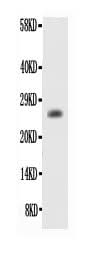 Anti-Bcl2 alpha Antibody Picoband® Boster Bio