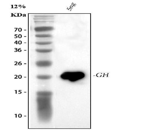 Anti-Growth Hormone/GH1 Antibody Picoband® Boster Bio
