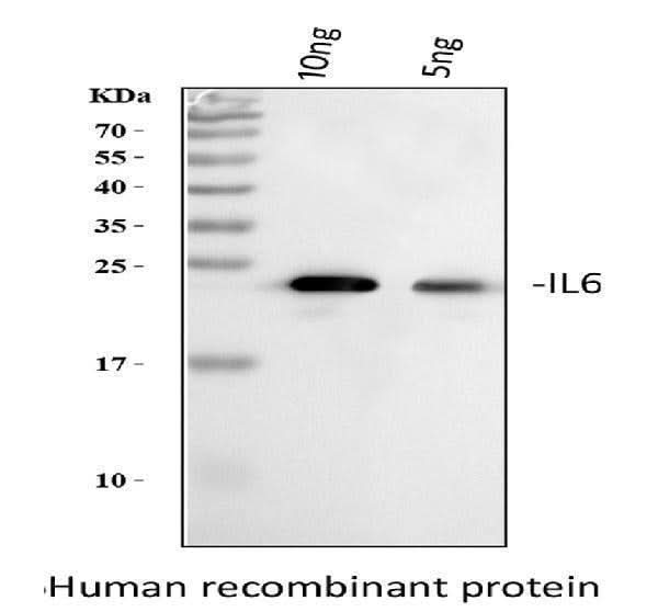 Anti-Interleukin-6 IL6 Antibody Picoband® Boster Bio