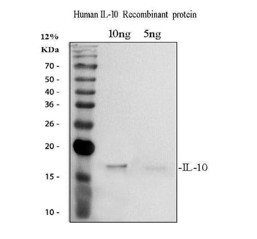Anti-Interleukin-10 IL10 Antibody Picoband® Boster Bio