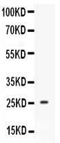 Anti-Prolactin Prl Antibody Picoband® Boster Bio
