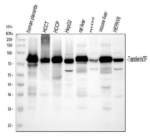 Anti-Transferrin/TF Antibody Picoband® Boster Bio