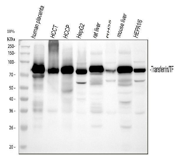 Anti-Transferrin/TF Antibody Picoband® Boster Bio