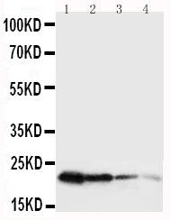 Anti-Growth Hormone/GH1 Antibody Picoband® Boster Bio