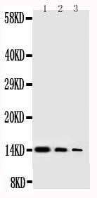 Anti-Beta-nerve growth factor NGF Antibody Picoband® Boster Bio
