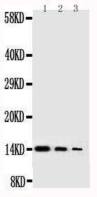Anti-Beta-nerve growth factor NGF Antibody Picoband® Boster Bio