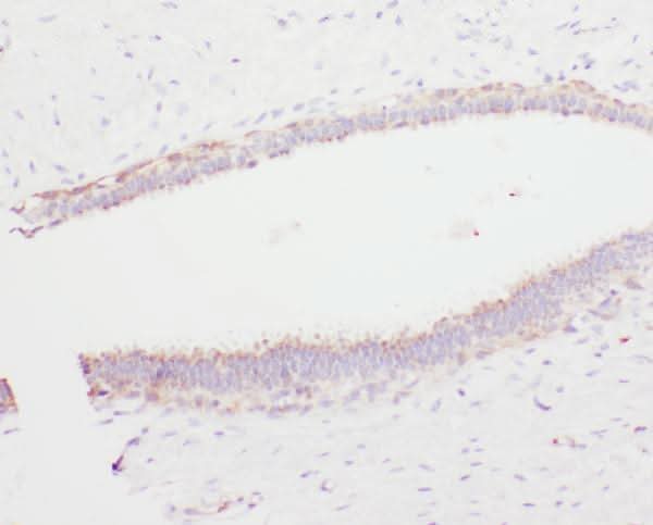 Anti-Angiostatin K1-3/PLG Antibody Picoband® Boster Bio