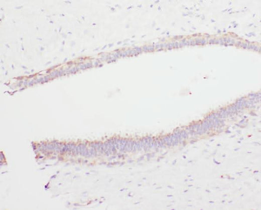 Anti-Angiostatin K1-3/PLG Antibody Picoband® Boster Bio