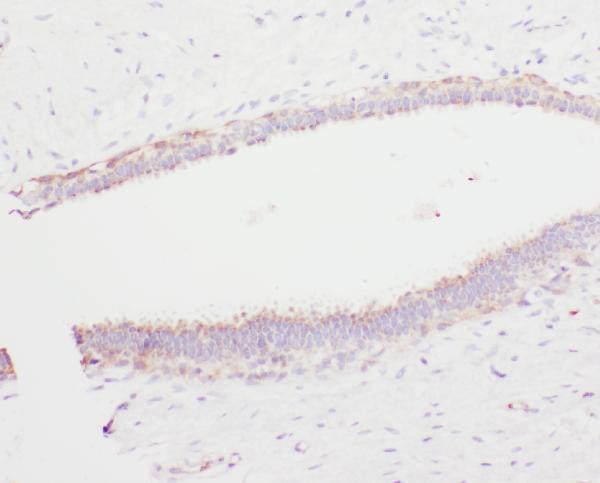 Anti-Angiostatin K1-3/PLG Antibody Picoband® Boster Bio
