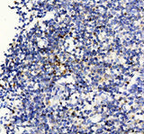 Anti-Forkhead box protein P3 FOXP3 Antibody Boster Bio