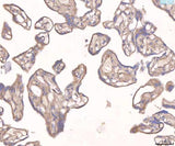 Anti-Angiopoietin 2/ANGPT2 Antibody Boster Bio