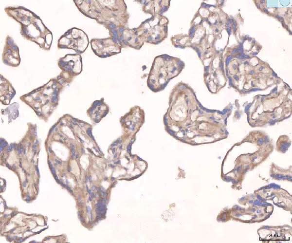 Anti-Angiopoietin 2/ANGPT2 Antibody Boster Bio
