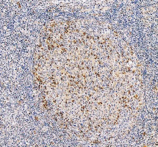 Anti-PD1/PDCD1 Antibody Picoband® Boster Bio