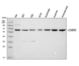Anti-Cystathionine beta-synthase CBS Antibody Picoband® Boster Bio